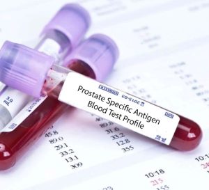 blodprøve for PSA test